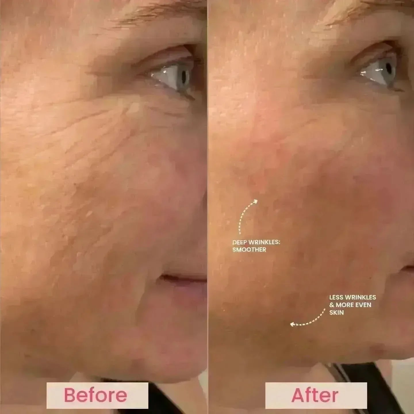 Lumo⁺ + Venus + Phoenix: Ultimate Trio for Youthful and Radiant Skin