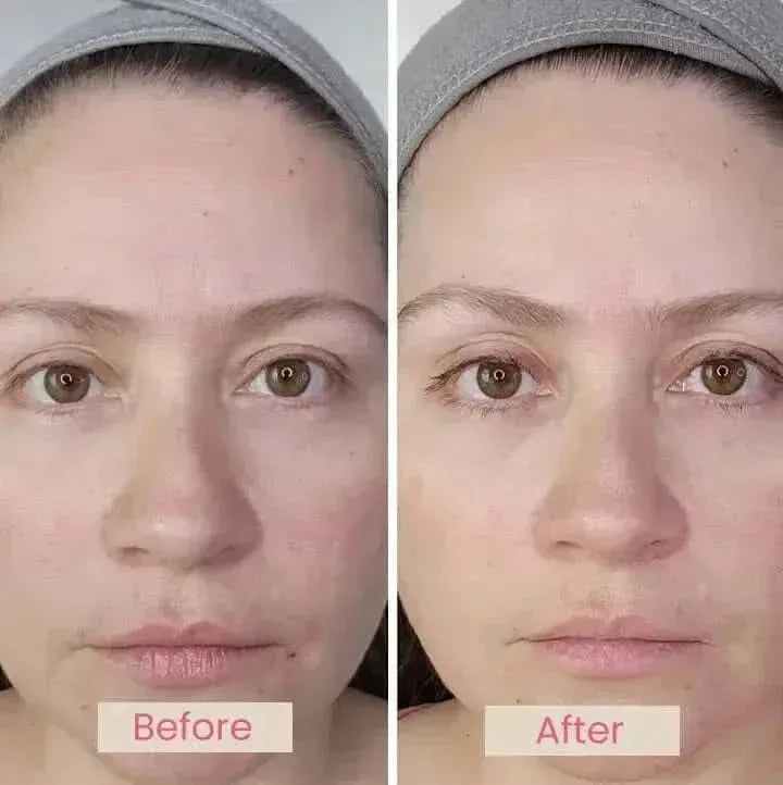 Lumo⁺ + Mirage + Venus: Complete Anti-Aging and Skin Rejuvenation Set
