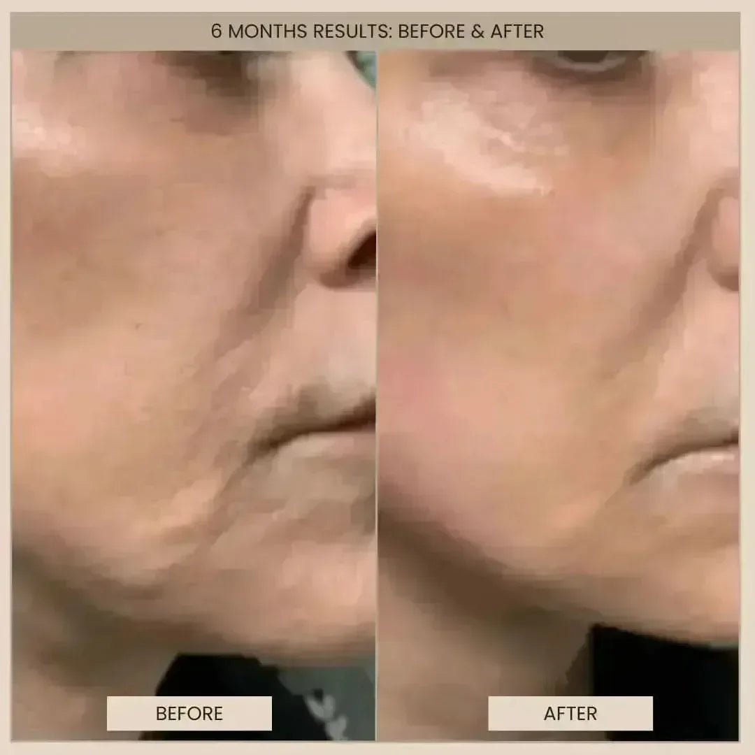 EvenSkyn® Lumo⁺: Premium Anti-Aging & Skin Tightening Handset (2026)